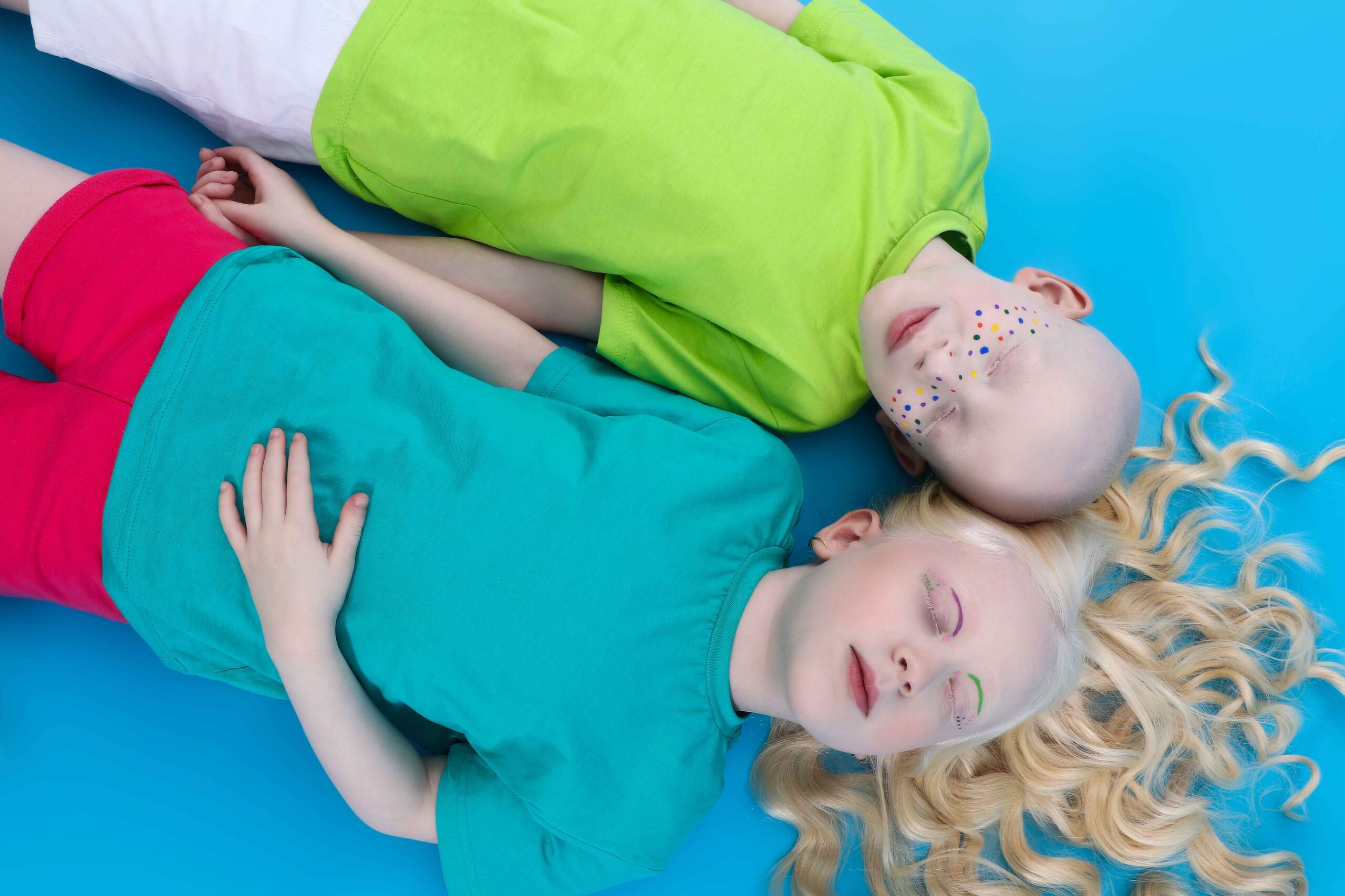 Você está visualizando atualmente Albinismo: editorial de moda chama atenção contra o preconceito 