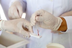Leia mais sobre o artigo Saúde Estadual reforça importância da testagem para hepatites B e C durante campanha Julho Amarelo